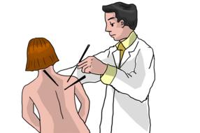 acupuncturist peope drawing