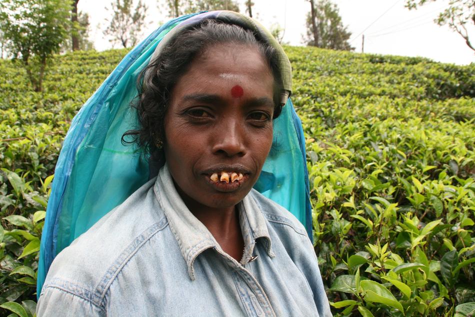 unusual woman india teeth